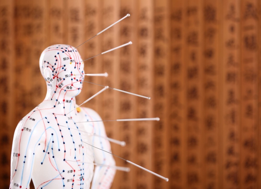 Acupunctura_mic